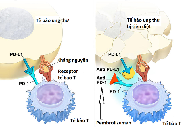 Các phương pháp điều trị nội khoa ung thư tiền liệt tuyến - 3 Các phương pháp điều trị nội khoa ung thư tiền liệt tuyến - 3