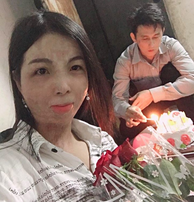 Mối tình đẹp của anh shipper điển trai và cô gái mặt đầy sẹo vì bỏng - 2 Mối tình đẹp của anh shipper điển trai và cô gái mặt đầy sẹo vì bỏng - 2
