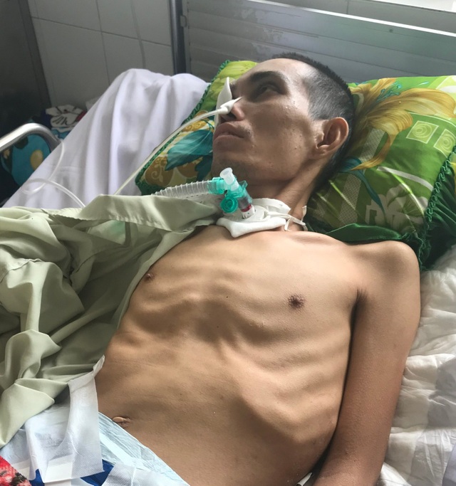 Thương người mẹ nghèo bệnh tật lận đận rời quê vào chăm con sau vụ tai nạn - 1 Thương người mẹ nghèo bệnh tật lận đận rời quê vào chăm con sau vụ tai nạn - 1