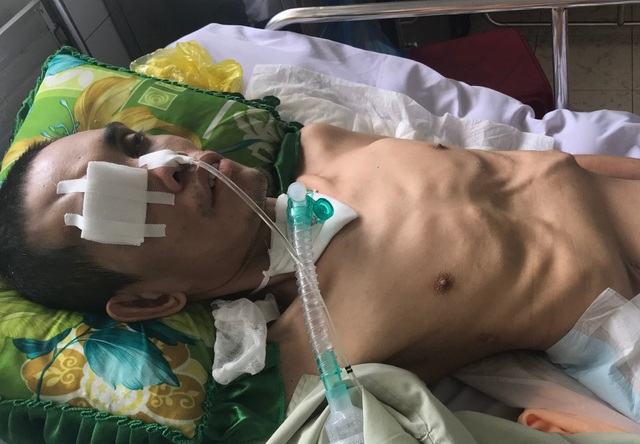 Thương người mẹ nghèo bệnh tật lận đận rời quê vào chăm con sau vụ tai nạn - 2 Thương người mẹ nghèo bệnh tật lận đận rời quê vào chăm con sau vụ tai nạn - 2