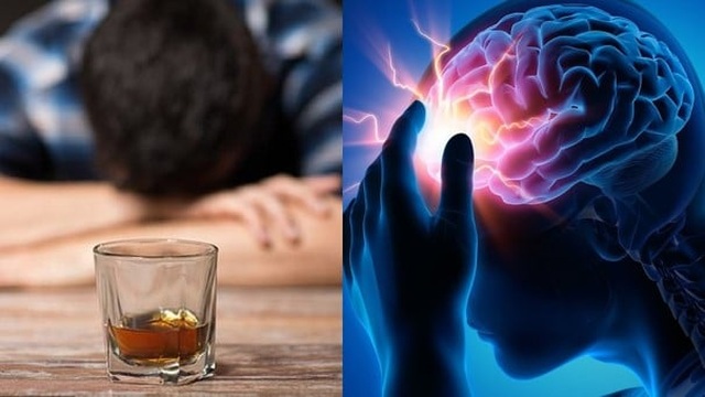 Người đàn ông 40 tuổi đã chảy máu não chỉ vì mê uống rượu - 1