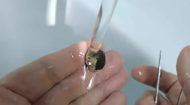 Người đàn ông mắc kẹt đồng xu trong mũi suốt 50 năm - 1 Người đàn ông mắc kẹt đồng xu trong mũi suốt 50 năm - 1