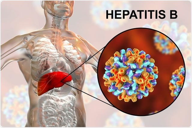 Loại virus có khả năng lây nhiễm mạnh gấp 100 lần HIV - 1 Loại virus có khả năng lây nhiễm mạnh gấp 100 lần HIV - 1