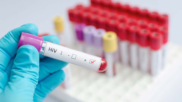 Nỗi sợ bị kỳ thị hơn cả cái chết của người phụ nữ nhiễm HIV từ chồng - 1 Nỗi sợ bị kỳ thị hơn cả cái chết của người phụ nữ nhiễm HIV từ chồng - 1