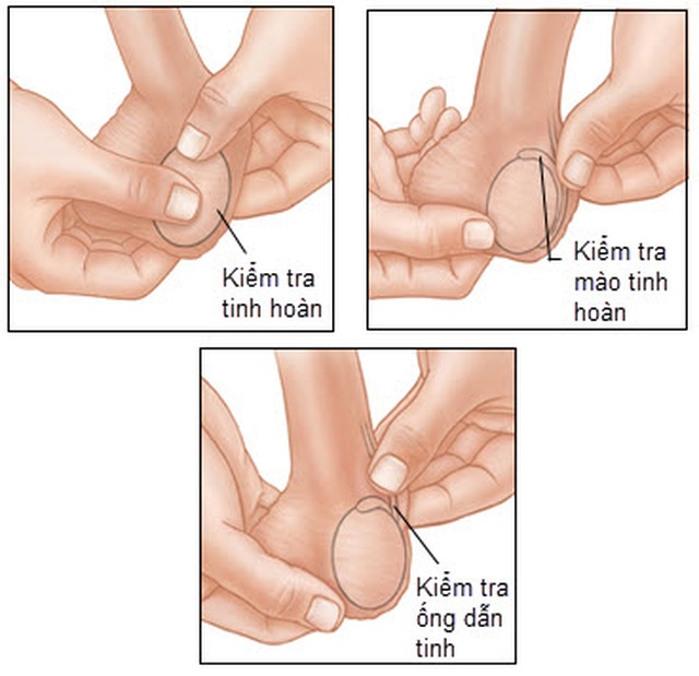 Hướng dẫn nam giới tự khám giúp phát hiện sớm ung thư tinh hoàn - 1 Hướng dẫn nam giới tự khám giúp phát hiện sớm ung thư tinh hoàn - 1