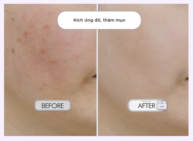 Kem dưỡng trắng da Cos Nine Hàn Quốc - Nuôi dưỡng làn da sáng đẹp tự nhiên - 4 Kem dưỡng trắng da Cos Nine Hàn Quốc - Nuôi dưỡng làn da sáng đẹp tự nhiên - 4