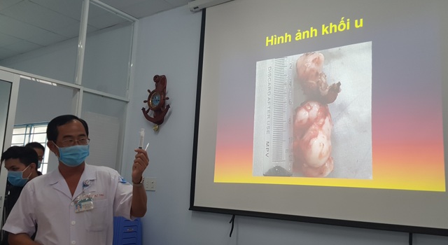 Bé trai thường xuyên bị chảy máu mũi vì bệnh lý nguy hiểm - 3 Bé trai thường xuyên bị chảy máu mũi vì bệnh lý nguy hiểm - 3
