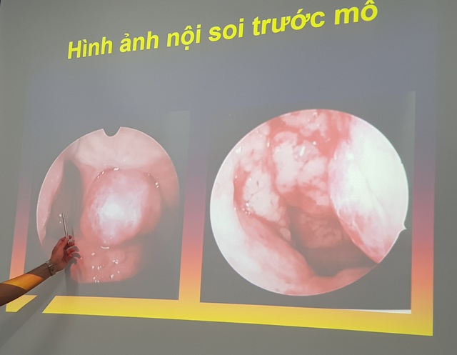 Bé trai thường xuyên bị chảy máu mũi vì bệnh lý nguy hiểm - 2 Bé trai thường xuyên bị chảy máu mũi vì bệnh lý nguy hiểm - 2