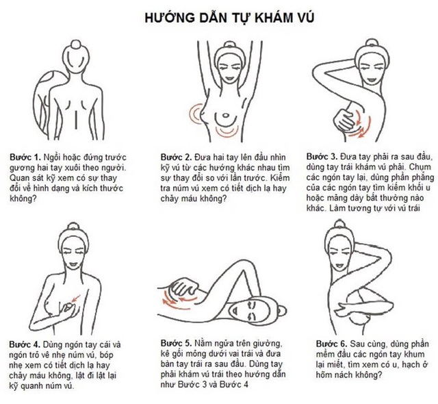 Ung thư vú 90% khỏi bệnh nếu phát hiện sớm - 1 Ung thư vú 90% khỏi bệnh nếu phát hiện sớm - 1