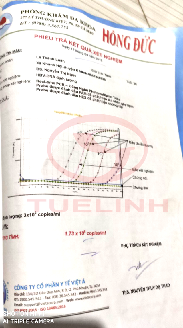 Cách âm tính virus viêm gan B chỉ sau 6 tháng của chàng trai trẻ - 2 Cách âm tính virus viêm gan B chỉ sau 6 tháng của chàng trai trẻ - 2