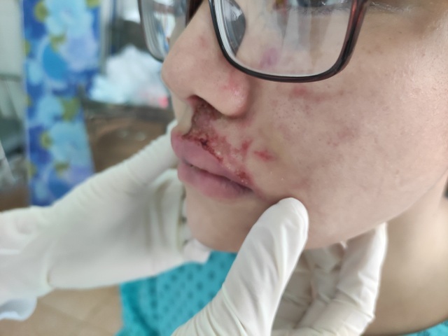 Làm đẹp cấp tốc đón Tết, hàng loạt phụ nữ gặp họa - 5 Làm đẹp cấp tốc đón Tết, hàng loạt phụ nữ gặp họa - 5