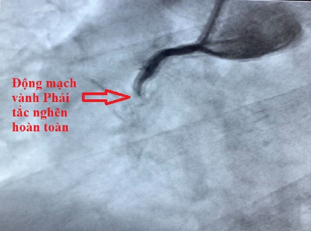 Dậy sớm đi uống cà phê trong thời tiết lạnh cụ ông đột ngột gục giữa đường - 1 Dậy sớm đi uống cà phê trong thời tiết lạnh cụ ông đột ngột gục giữa đường - 1