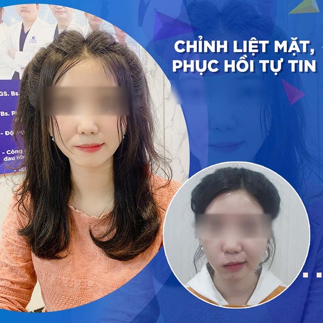 Bệnh viện thẩm mỹ Gangwhoo: Thông điệp xúc động đằng sau câu chuyện giải cứu dây thần kinh số 7 - 1 Bệnh viện thẩm mỹ Gangwhoo: Thông điệp xúc động đằng sau câu chuyện giải cứu dây thần kinh số 7 - 1