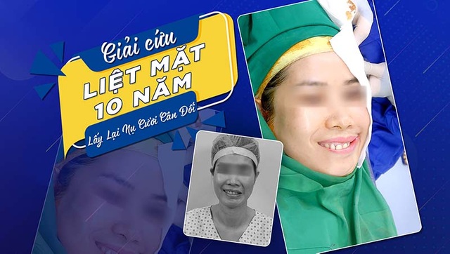 Bệnh viện thẩm mỹ Gangwhoo: Thông điệp xúc động đằng sau câu chuyện giải cứu dây thần kinh số 7 - 2 Bệnh viện thẩm mỹ Gangwhoo: Thông điệp xúc động đằng sau câu chuyện giải cứu dây thần kinh số 7 - 2