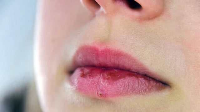Tóc bết, rụng nhiều: Có thể gan đang cầu cứu - 2 Tóc bết, rụng nhiều: Có thể gan đang cầu cứu - 2