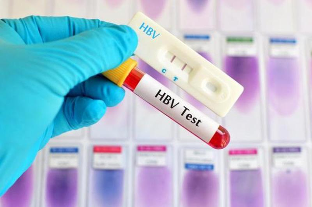 Những biện pháp giúp chẩn đoán viêm gan B - 2 Những biện pháp giúp chẩn đoán viêm gan B - 2