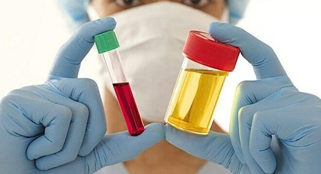 Đau lưng, tiểu ra máu thận trọng với ung thư niệu quản - 1 Đau lưng, tiểu ra máu thận trọng với ung thư niệu quản - 1
