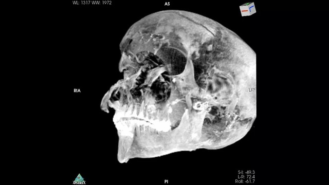 Xác ướp hé lộ pharaoh Ai Cập bị xử tử ngay trên chiến trường - 1 Xác ướp hé lộ pharaoh Ai Cập bị xử tử ngay trên chiến trường - 1