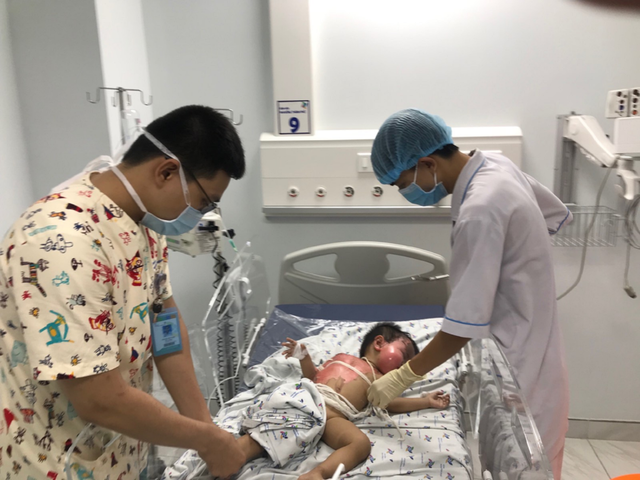 Với ca nước nóng trên bàn, bé trai bị bỏng toàn bộ vùng đầu, mặt - 1 Với ca nước nóng trên bàn, bé trai bị bỏng toàn bộ vùng đầu, mặt - 1