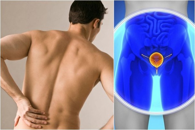 Loại ung thư ở nam giới có thể chữa khỏi nếu phát hiện sớm - 2 Loại ung thư ở nam giới có thể chữa khỏi nếu phát hiện sớm - 2