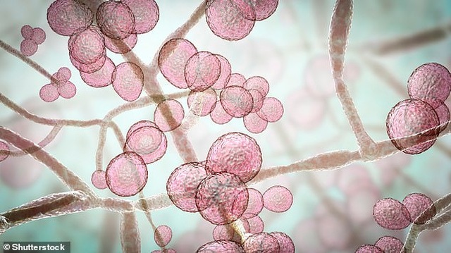 Phát hiện mới về loại nấm khiến nhiều người nhiễm tử vong trong 90 ngày - 1