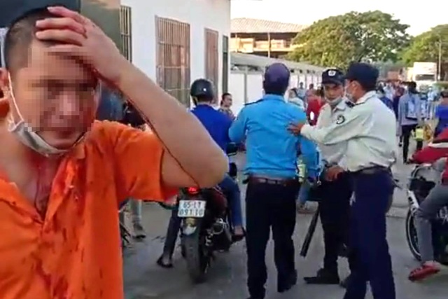 Nhóm bảo vệ vung gậy sắt đánh dã man công nhân trước cổng công ty - 2 Nhóm bảo vệ vung gậy sắt đánh dã man công nhân trước cổng công ty - 2