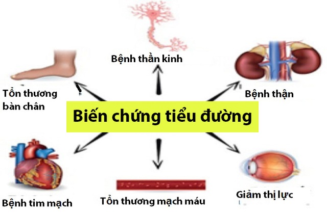 Bí quyết của người bệnh tiểu đường từ phức hợp: hoa hòe - nghệ - mã đề - 2 Bí quyết của người bệnh tiểu đường từ phức hợp: hoa hòe - nghệ - mã đề - 2