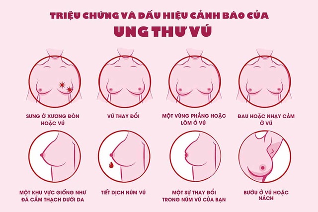 Dấu hiệu ban đầu của ung thư vú - 2