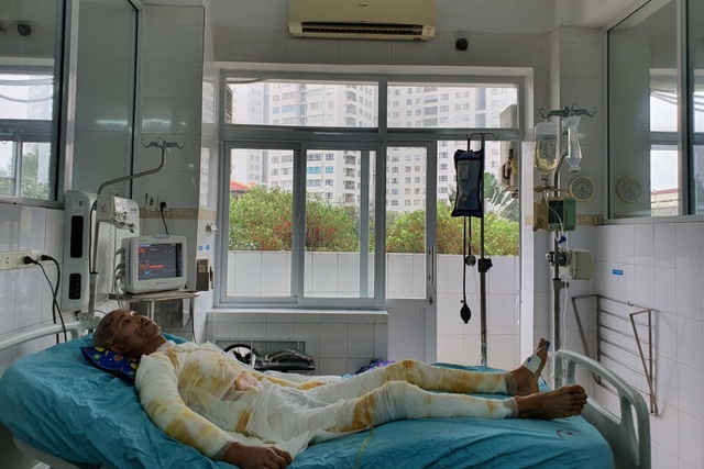 Chàng trẻ nguy kịch sau vụ tai nạn thương tâm mất nửa phần da cơ thể - 6 Chàng trẻ nguy kịch sau vụ tai nạn thương tâm mất nửa phần da cơ thể - 6
