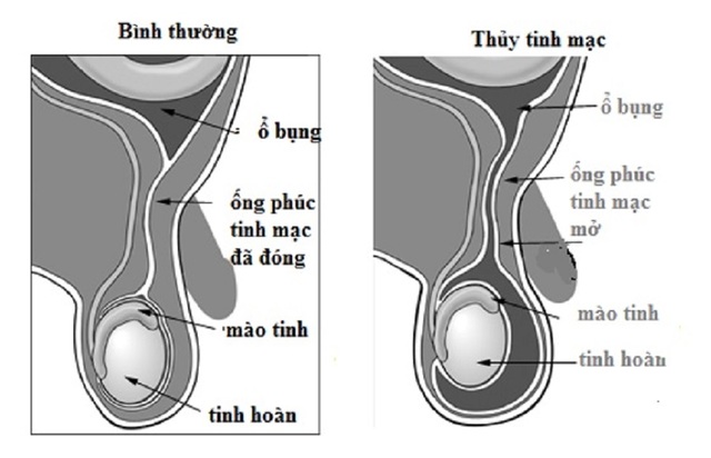 Kỳ lạ, cậu bé có tinh hoàn lớn ban ngày nhỏ về đêm - 2 Kỳ lạ, cậu bé có tinh hoàn lớn ban ngày nhỏ về đêm - 2