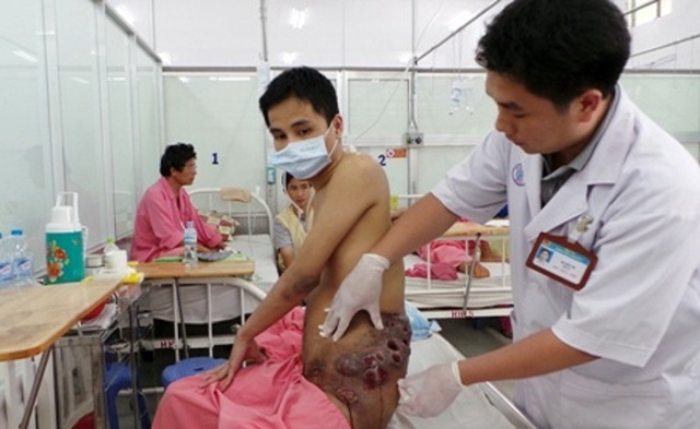 Một bệnh nhân được Bảo hiểm y tế chi trả 38,3 tỷ đồng - 1 Một bệnh nhân được Bảo hiểm y tế chi trả 38,3 tỷ đồng - 1
