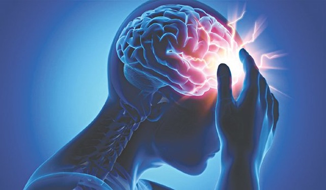 Nghiên cứu mới: Covid-19 ảnh hưởng nghiêm trọng tới não, dễ gây đột quỵ - 1