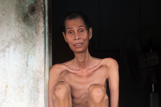 Thương người đàn ông gầy nhất vùng trong ngôi nhà 4 mảnh đời nghèo bền vững - 3 Thương người đàn ông gầy nhất vùng trong ngôi nhà 4 mảnh đời nghèo bền vững - 3