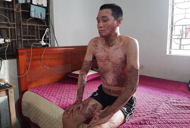 Đau nhói lòng gia cảnh người đàn ông bị đồng nghiệp ra tay tàn độc - 2 Đau nhói lòng gia cảnh người đàn ông bị đồng nghiệp ra tay tàn độc - 2