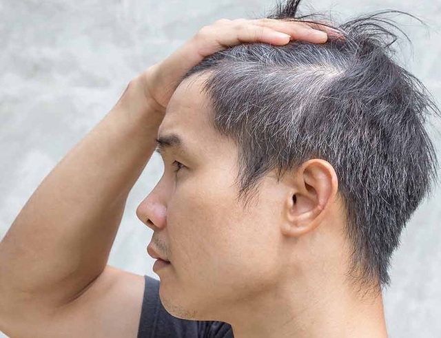 Sắc mun - dầu gội phủ bạc giúp tóc đen bóng trở lại - 1 Sắc mun - dầu gội phủ bạc giúp tóc đen bóng trở lại - 1