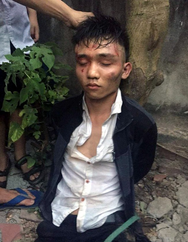 Hà Nội: Tên cướp manh động cứa cổ chủ tiệm tạp hóa - 2 Một trong 2 tên cướp bị bắt sống.