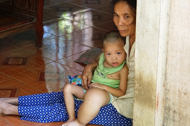 Xót xa nhìn bé 3 tuổi mang nỗi đau phì đại chân tay - 9 Ánh mắt bà cháu như đang cầu cứu điều gì đó.