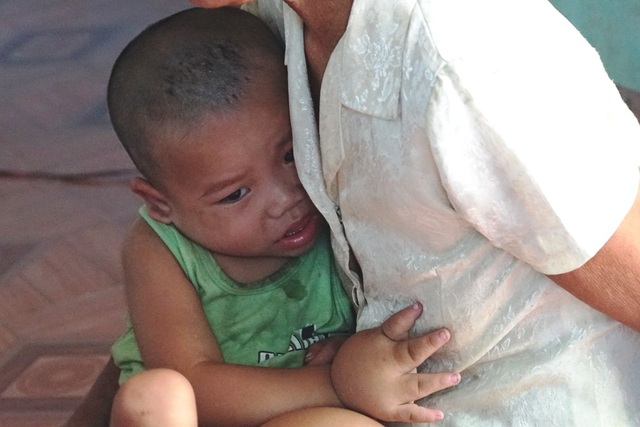Xót xa nhìn bé 3 tuổi mang nỗi đau phì đại chân tay - 10 Bé con hễ cứ thấy người lạ là khóc, ôm lấy bà.