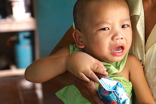 Xót xa nhìn bé 3 tuổi mang nỗi đau phì đại chân tay - 4 Mang căn bệnh chân voi nên cháu Minh rất đau đớn.