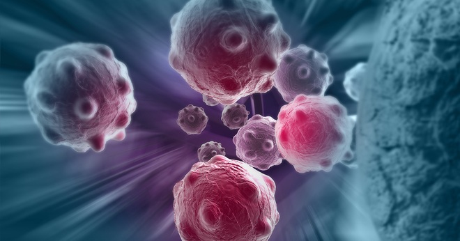 Tế bào ung thư khác tế bào lành như thế nào?