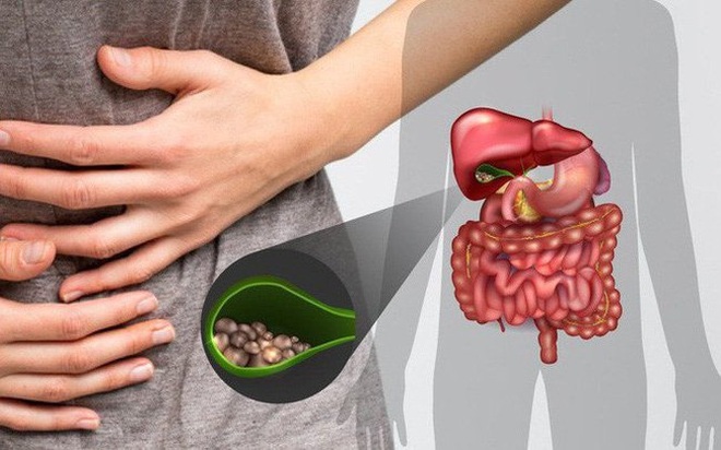 Ung thư túi mật khó phát hiện ở giai đoạn sớm - 1 Ung thư túi mật khó phát hiện ở giai đoạn sớm - 1