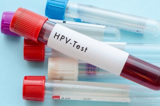 Nam giới có nên tiêm vắc xin HPV? - 1