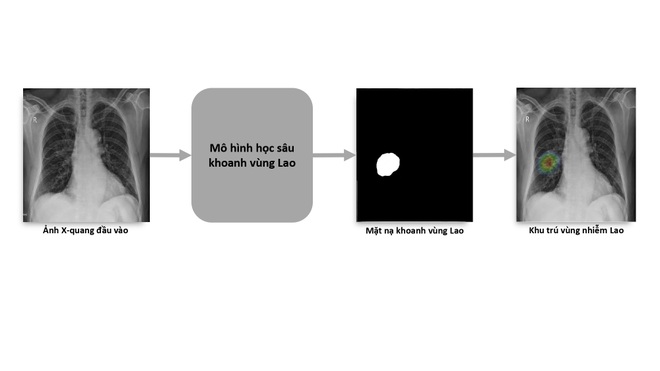 VinBrain và FIT phát hành sách trắng ứng dụng AI cho chuẩn đoán và tầm soát bệnh lao - 2