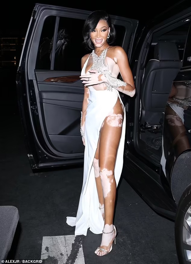 Siêu mẫu bạch biến Winnie Harlow gây choáng với váy xẻ bất tận - 1 Siêu mẫu bạch biến Winnie Harlow gây choáng với váy xẻ bất tận - 1