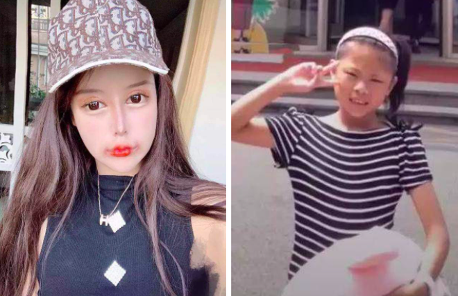 Gương mặt biến dạng của hotgirl nghiện dao kéo thẩm mỹ từ năm 13 tuổi - 3 Gương mặt biến dạng của hotgirl nghiện dao kéo thẩm mỹ từ năm 13 tuổi - 3
