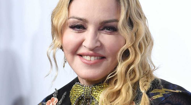 Madonna khác lạ trong loạt ảnh chỉnh sửa quá đà - 5