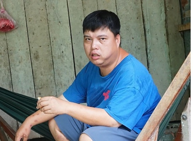 Số phận người đàn ông khốn khổ và những tai ương trùng hợp đến khó tin - 2 Số phận người đàn ông khốn khổ và những tai ương trùng hợp đến khó tin - 2