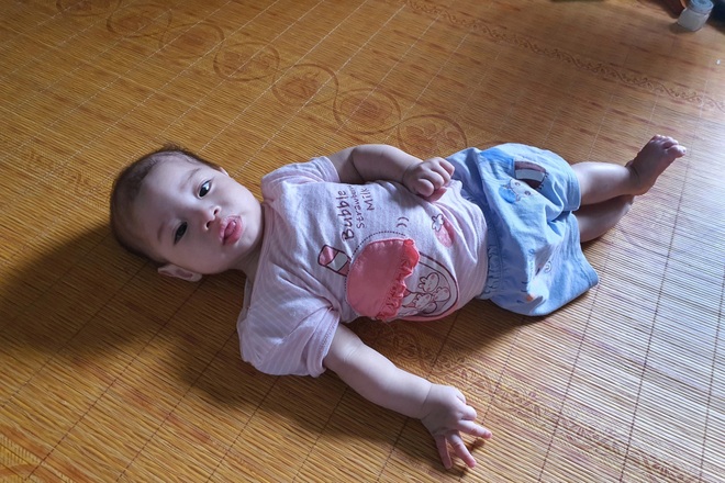 Nhói lòng cảnh bé gái 1 tuổi người mềm oặt, ngày lên cơn co giật mấy lần - 1 Nhói lòng cảnh bé gái 1 tuổi người mềm oặt, ngày lên cơn co giật mấy lần - 1