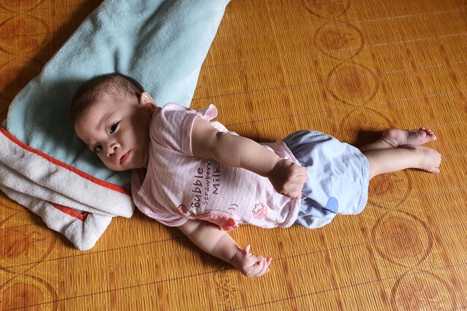 Nhói lòng cảnh bé gái 1 tuổi người mềm oặt, ngày lên cơn co giật mấy lần - 2 Nhói lòng cảnh bé gái 1 tuổi người mềm oặt, ngày lên cơn co giật mấy lần - 2