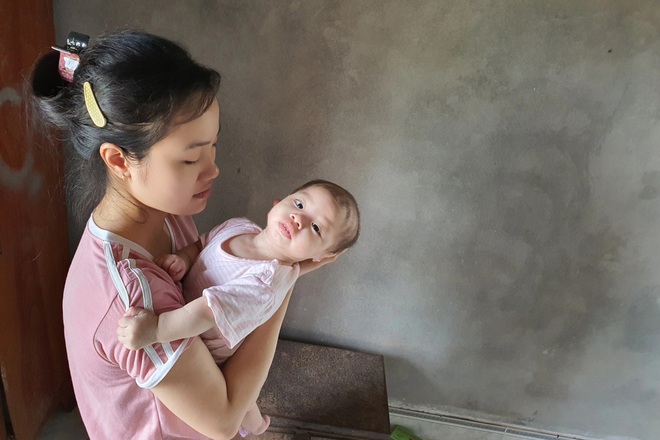 Nhói lòng cảnh bé gái 1 tuổi người mềm oặt, ngày lên cơn co giật mấy lần - 3 Nhói lòng cảnh bé gái 1 tuổi người mềm oặt, ngày lên cơn co giật mấy lần - 3